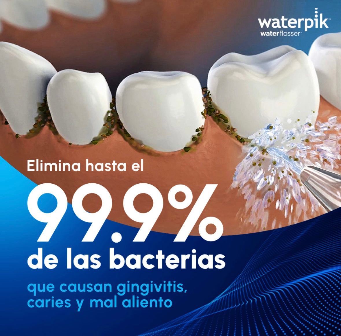 Waterpik (irrigador bucal)